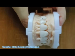 জিরকোনিয়া মুকুট