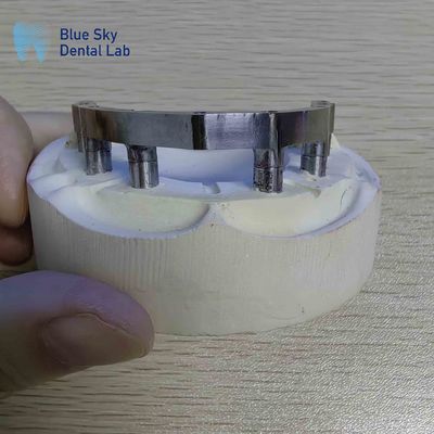কেনা দাঁতের ইমপ্লান্টের জন্য টাইটানিয়াম বার online manufacture