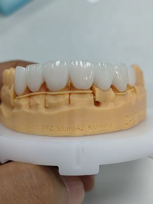 কেনা 5 মিমি-6 মিমি স্তরযুক্ত জিরকোনিয়া মুকুট শক্তি জিরকোনিয়া মাল্টিলেয়ার মুকুট online manufacture