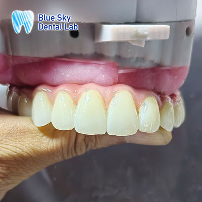 কেনা একাধিক ইমপ্লান্ট সিস্টেমের জন্য ইমপ্লান্টেশন কেস online manufacture