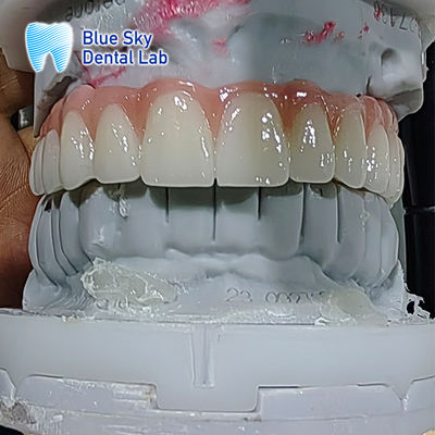 কেনা কৃত্রিম দাঁতের ইমপ্লান্ট কেস মাল্টিপল স্টেরিলাইজেশন ইমপ্লান্ট কেস online manufacture