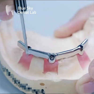 Precision Dental Titanium Bar With Precious Attachment জৈব সামঞ্জস্যপূর্ণ